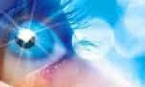 Процедура LASIK: полное руководство