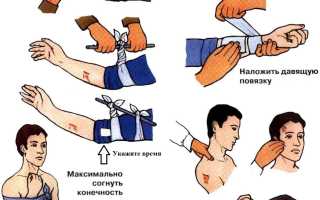 Что делать в первую очередь при открытой ране на руке