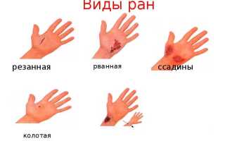 Травмы и ранения: виды и первая медицинская помощь