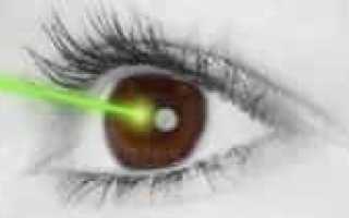 Результаты LASIK: чего ожидать?