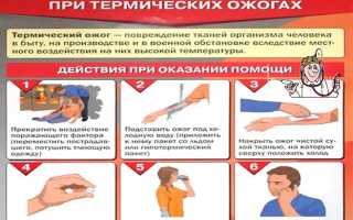Термические ожоги: их степени и правила оказания первой помощи
