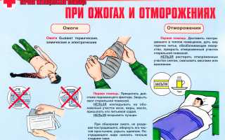 Что делать при ожогах огнем: советы и рекомендации
