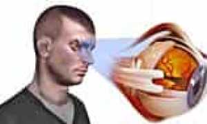Что происходит при глаукоме?