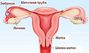 Что такое внематочная беременность? Обзор болезни