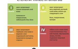 Ожог ноги: первая помощь взрослым и детям