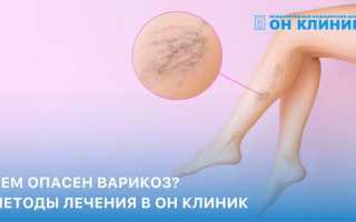 Судороги ног: виды, причины и правила оказания первой помощи