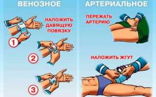 Виды кровотечений и первая помощь при них
