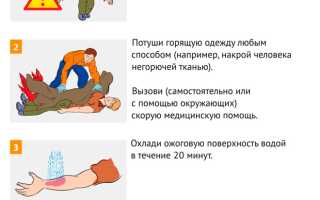 Оказание первой помощи при термическом и химическом ожогах