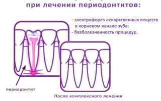 Электрофорез в практической стоматологии