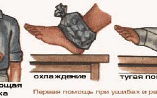 Оказание первой помощи при ушибах, растяжениях