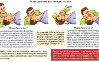 Это нужно знать каждому: как оказать первую медицинскую помощь самому!