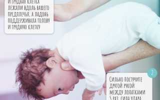 Ребенок подавился и задыхается: что делать?