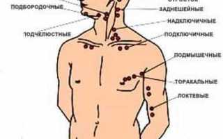 Причины боли в лимфатических узлах