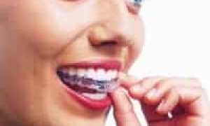 6 природных способов для отбеливания зубов