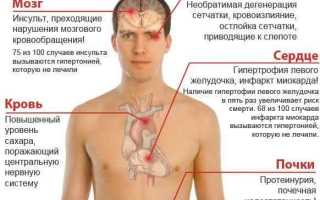 Гипертонический криз: причины, основные симптомы и первая помощь