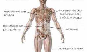 Вегетососудистая дистония. Что за зверь?