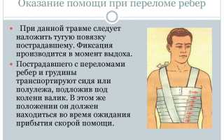 Необходимые действия и лечение при сломаном ребре