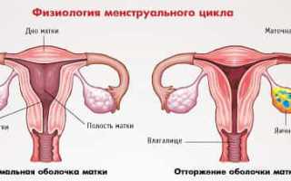 Аменорея — обзор болезни