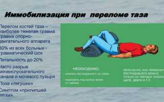 Перелом костей таза: симптоматика и первая помощь пострадавшему