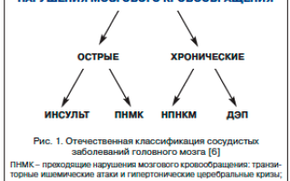 Острое нарушение мозгового кровообращения: типы и симптоматика