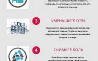 Как оказать первую помощь при вывихах суставов