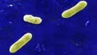Bordetella parapertussis