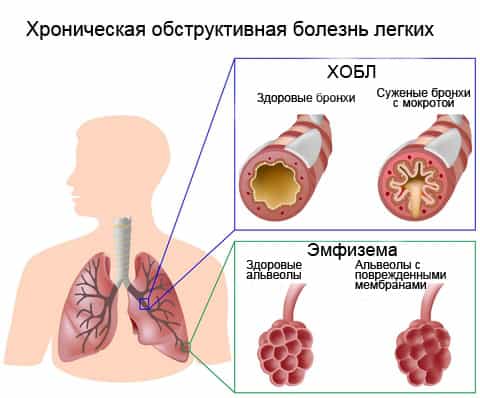 хобл