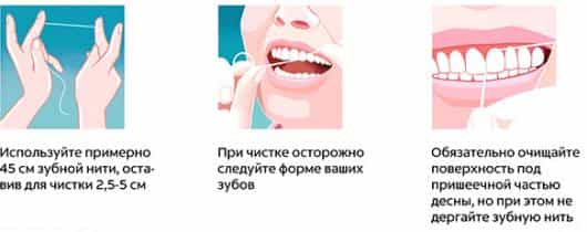 как пользоваться зубной нитью