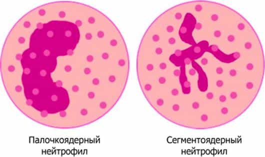 Нейтрофилы
