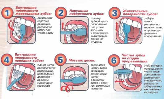правильная чистка зубов
