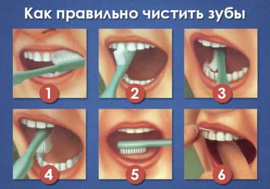 правильная чистка зубов
