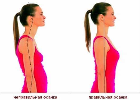 правильная осанка