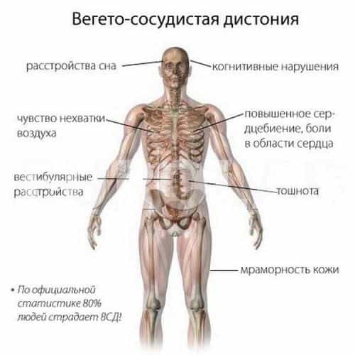 Вегетососудистая дистония